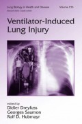 Ventilator-Induced Lung Injury, Volume 215